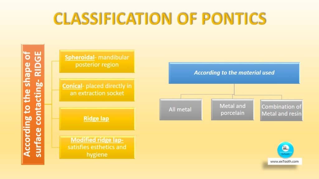 KNOW SELECTION CRITERIA FOR PONTIC AND DESIGNS! extooth