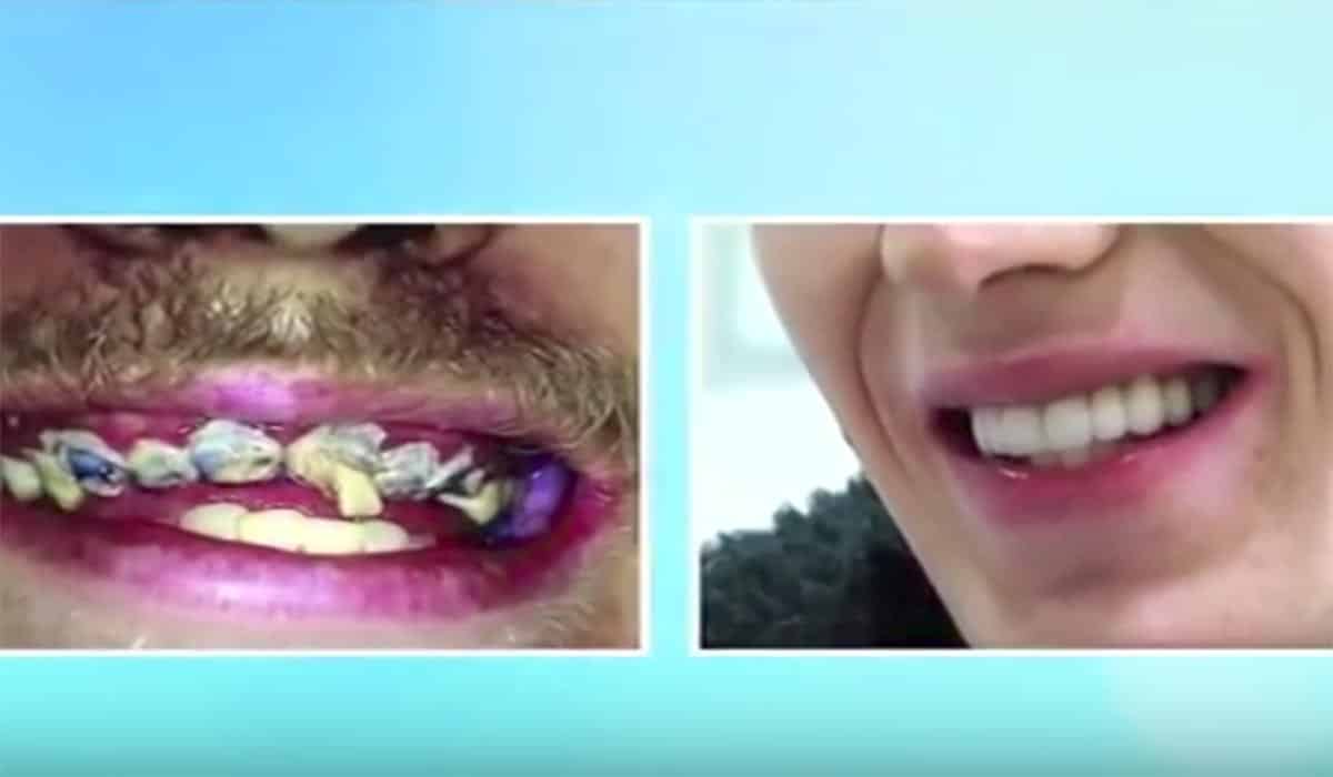 Here's what happens if you don't brush your teeth for 20 years Extra.ie
