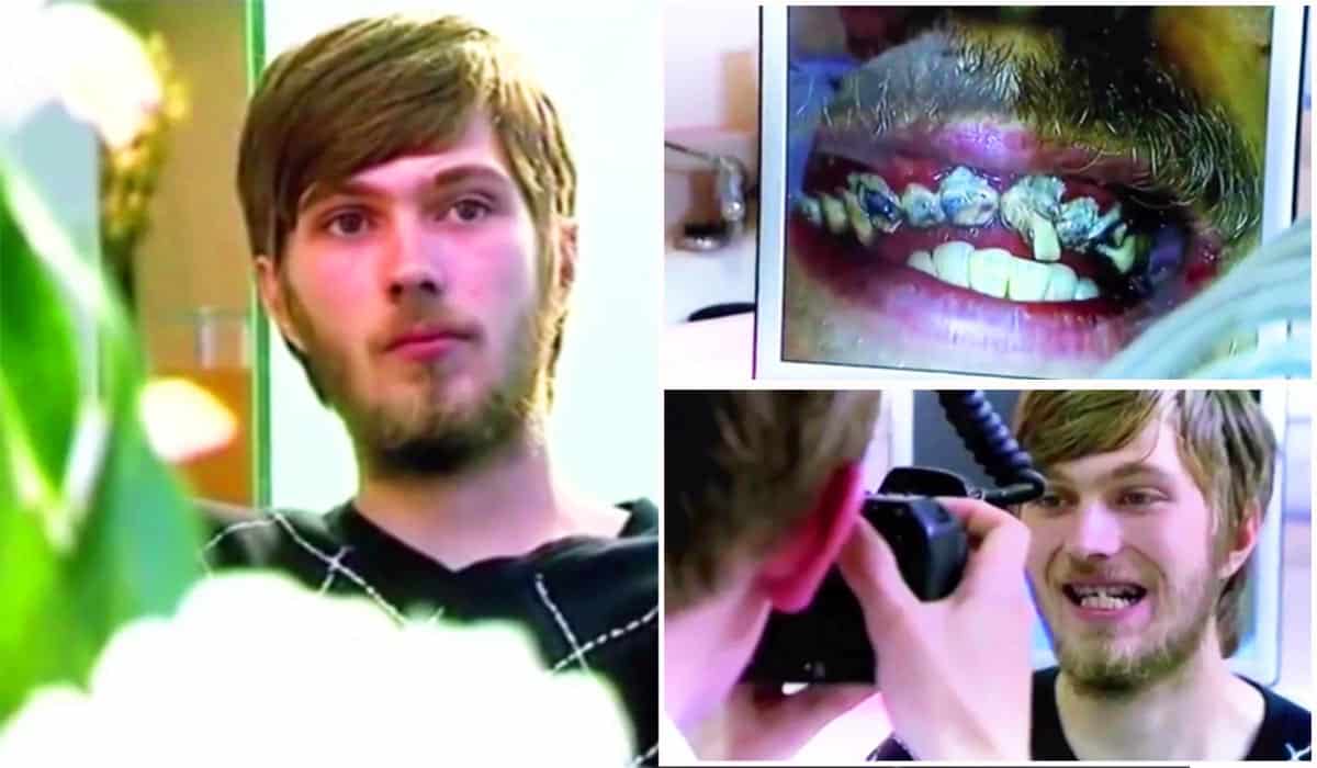 Here's what happens if you don't brush your teeth for 20 years Extra.ie