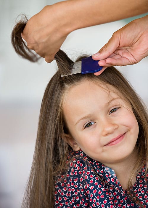 Head lice Everything You Need To Know As Kids Go Back To School