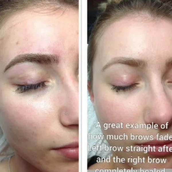 Eyebrow Cosmetic Tattooing Eyebrow Studio Sydney