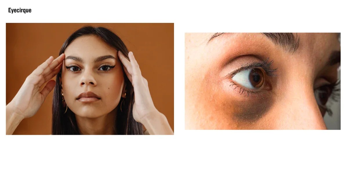 Can eye makeup cause dark circles? Debunking the myth Eyecirque Store