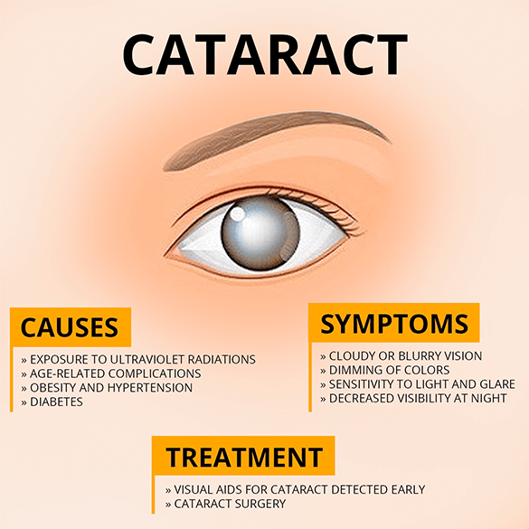 Cataract Is Caused By