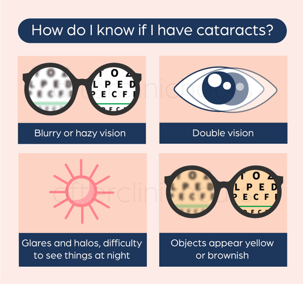 Cataract Symptoms How Do You Know If You Have Cataract?