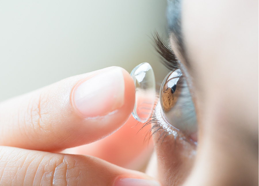 Contact Lens Overview Eye Patient