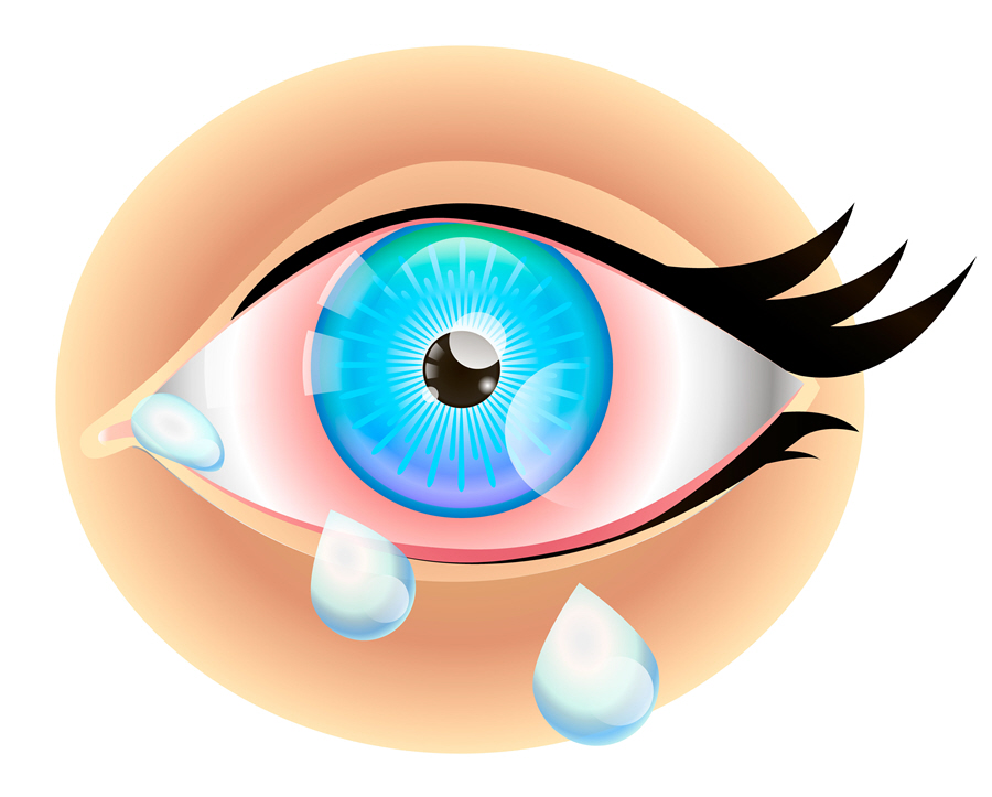 My twoyearold has watery eyes. Should I see a doctor? Eye Patient