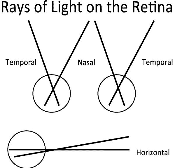 Visual Field Testing From One Medical Student to Another
