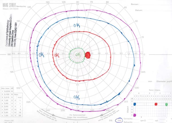Visual Field Testing: From One Medical Student to Another
