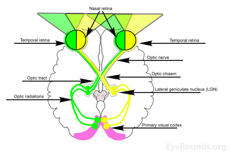 Amblyopia From One Medical Student to Another