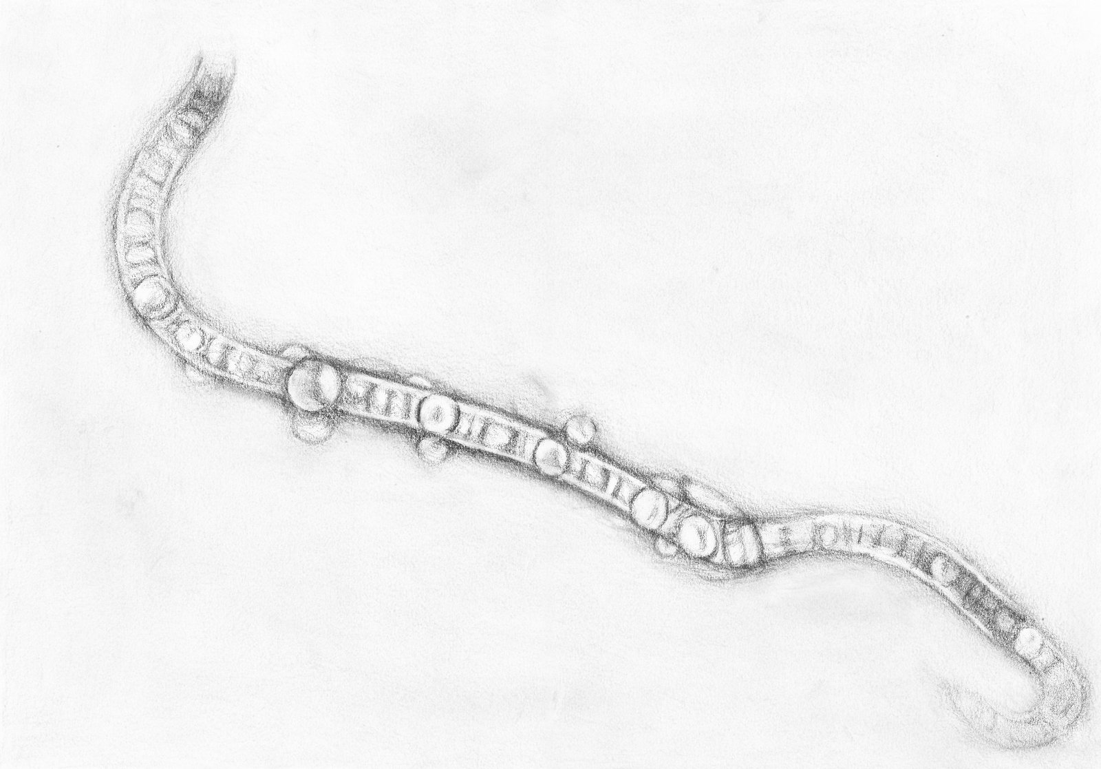 13 Tips On How To Reduce Floaters In Eyes Naturally Eyes Advisor