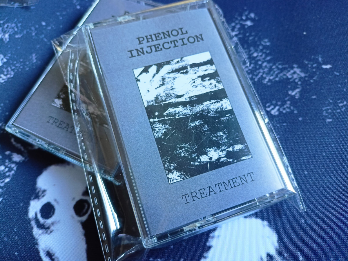 Phenol Injection Treatment Death In Venice Productions