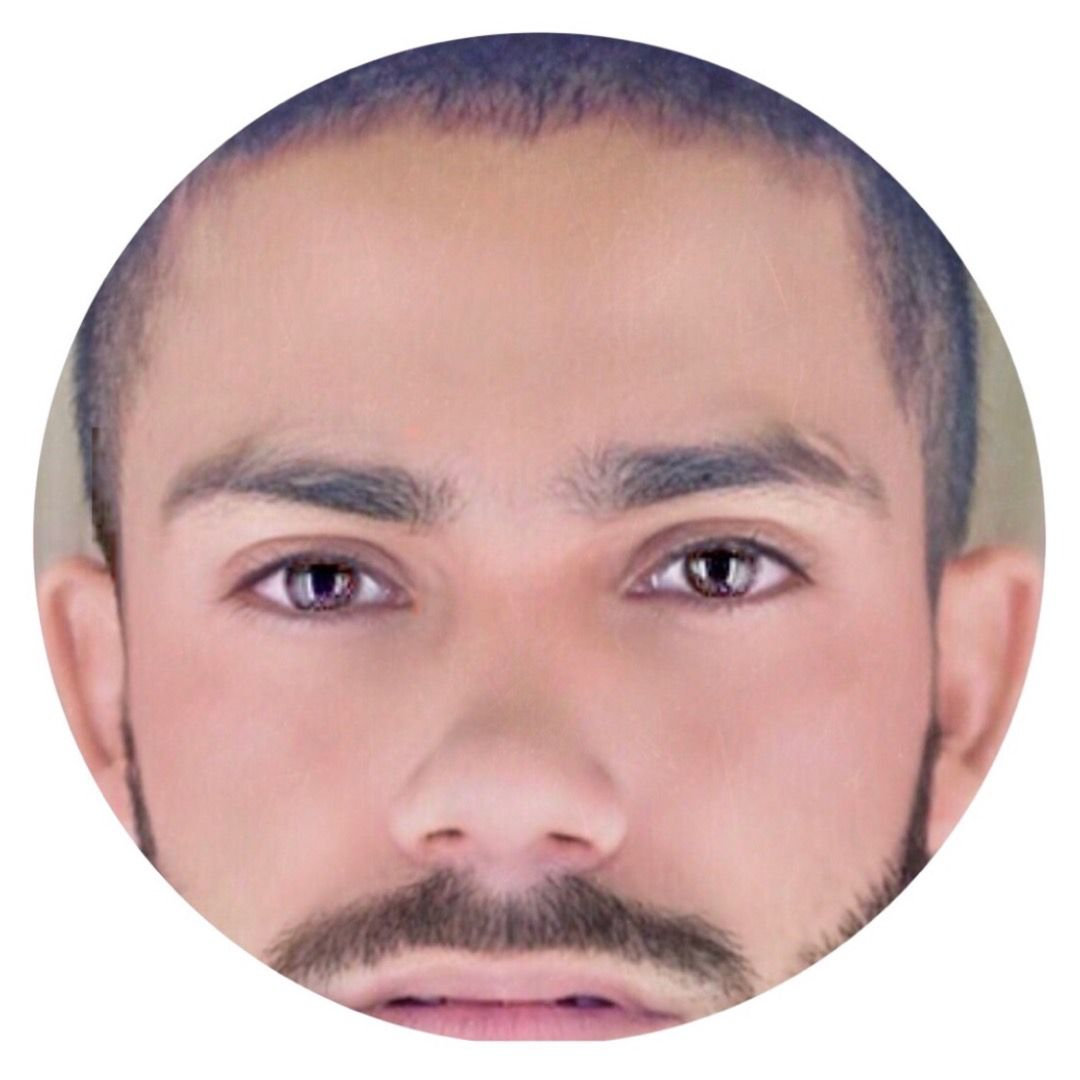 Lady Gaga Disease (Niv Remix GL7) Lady Gaga Niv Rock Jr