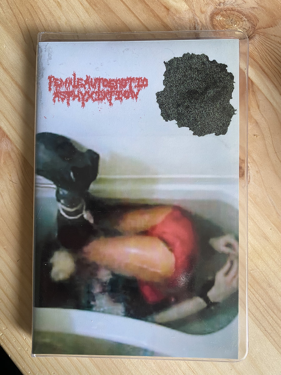 Autoerotic Asphyxiation