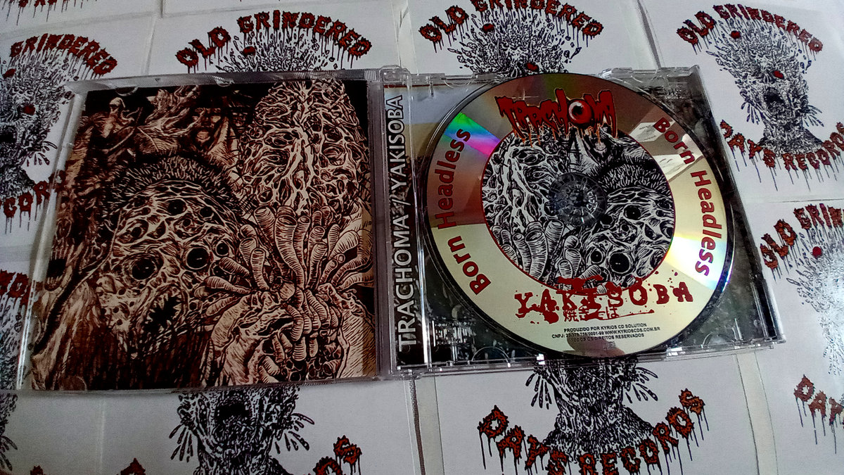 Trachoma Adipocere Corpse Wax Trachoma / Yakisoba Old Grindered