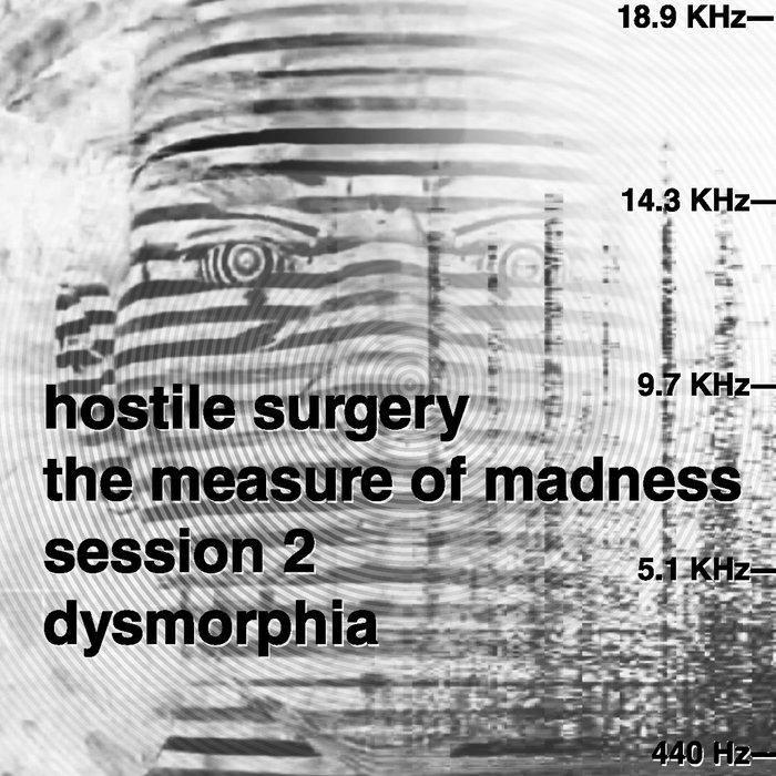 Dysmorphia Hostile Surgery Kalamine Records