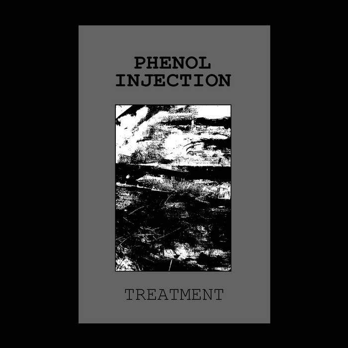 Phenol Injection Treatment Death In Venice Productions