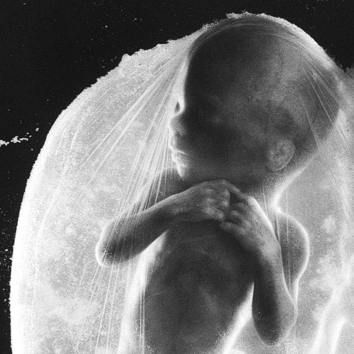 å¨é¨ä¸çæ²ä¼¤ Hke Cover Lvj Dfg Hollow Point One