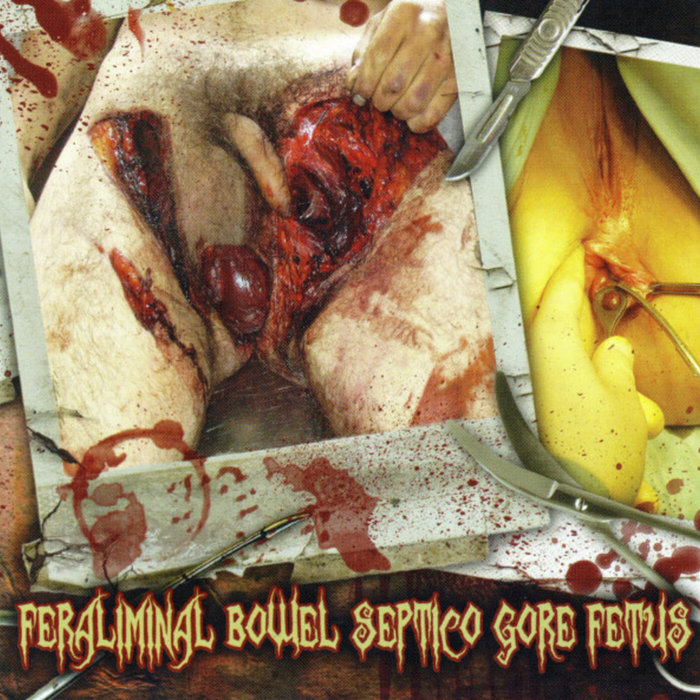 DEAD FETUS COLLECTION / GORE / SEPTICOPYEMIA / FERALIMINAL