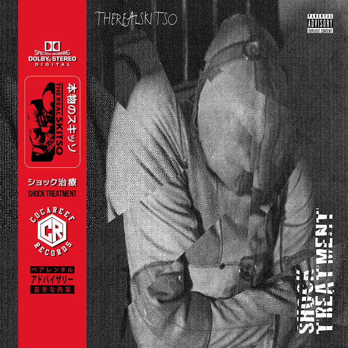 Shock Treatment TheRealSkitso Cocareef