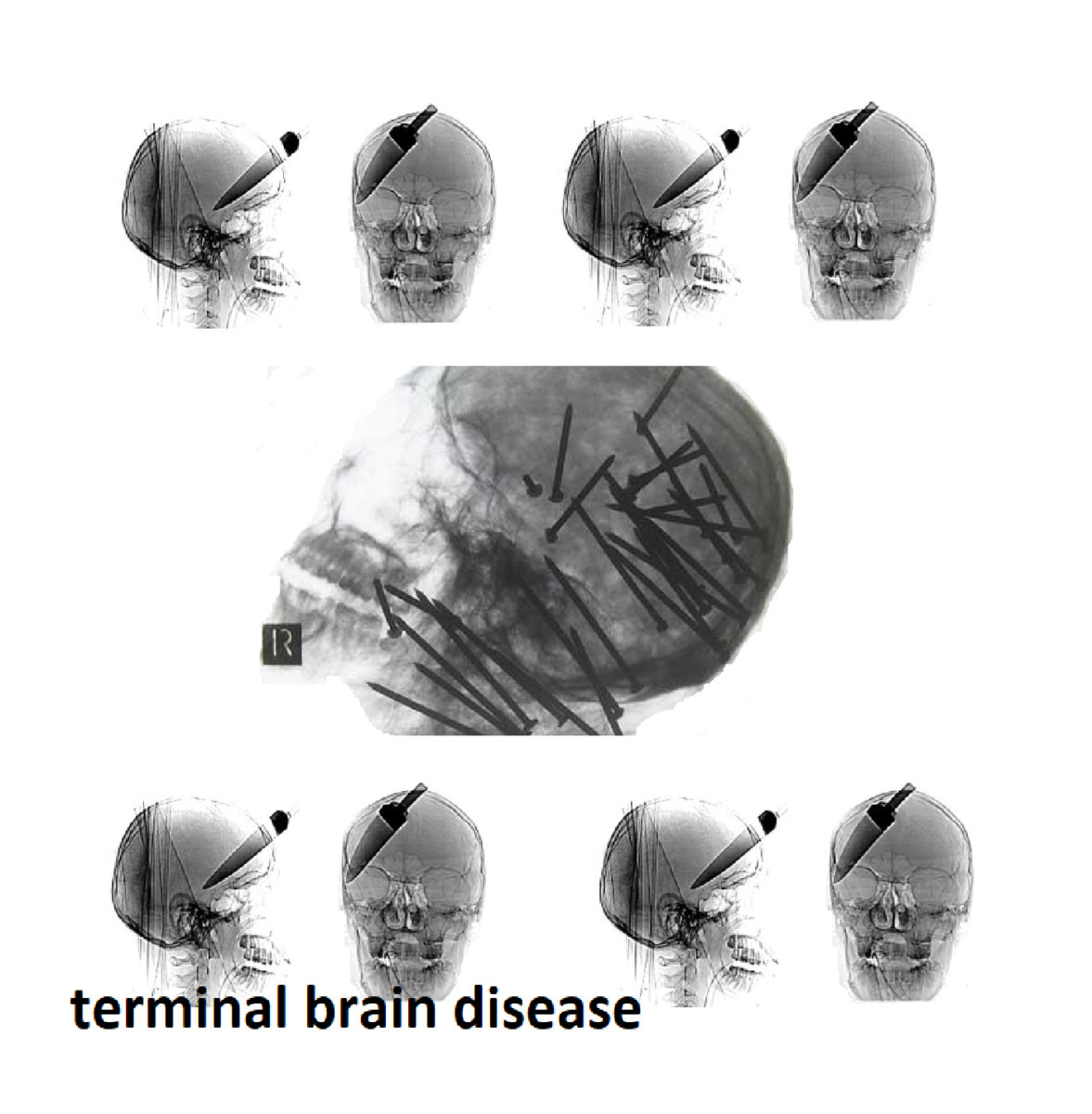 Terminal Brain Disease tbd Killer Tofu Records