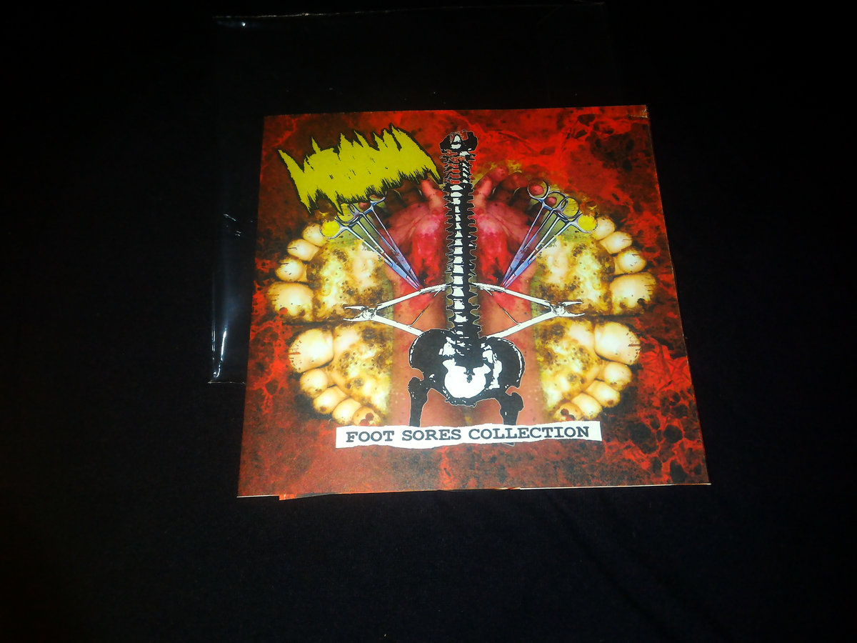 Rotten Beyond Recognition Old Grindered Days Records