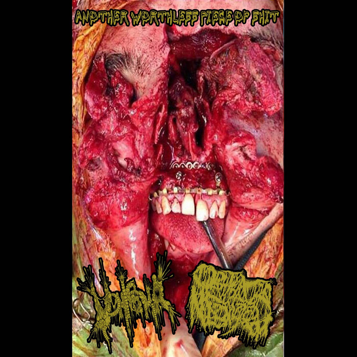 Another Worthless Piece Of Shit (Split With Vomitoma