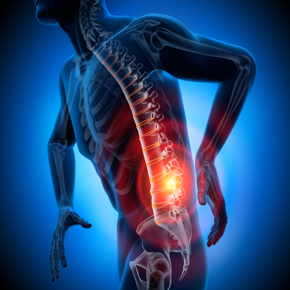 What is for Sciatica Pain?