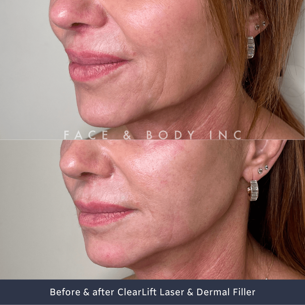 ClearLift Laser Face and Body Inc