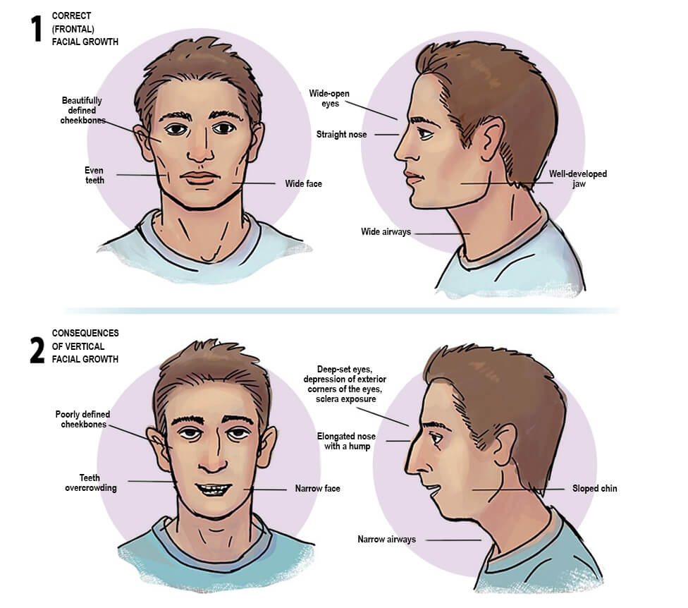 Myofunctional Therapy Face Fitness OMT