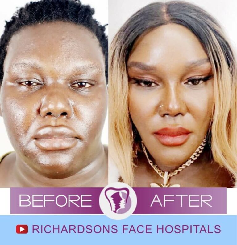 Four Things No One Told You About Complete Face Change Plastic Surgery
