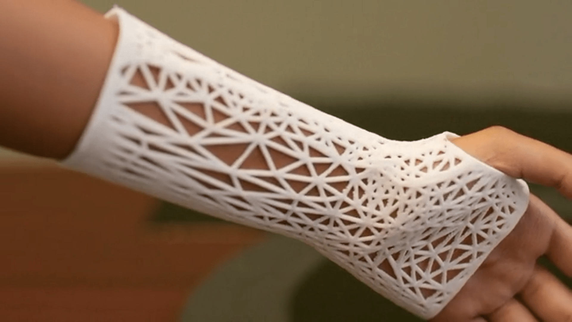 PrinterPrezz Partners with UCSF to Develop New 3D Printed Medical