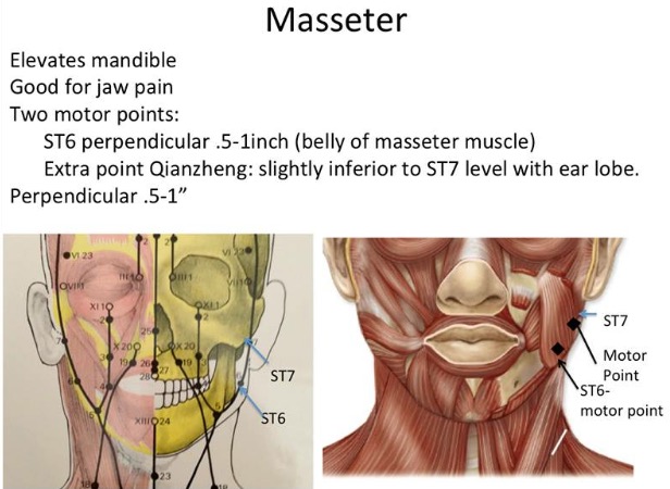 LIVE Webinar Treating Neuromuscular Facial Conditions Part 1