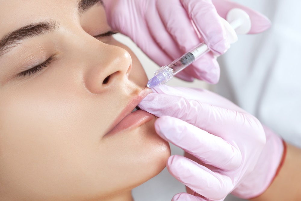 Lip Injections in Sacramento, CA Easy, Safe, and Beautiful Kaniff Cosmetic Medical Center