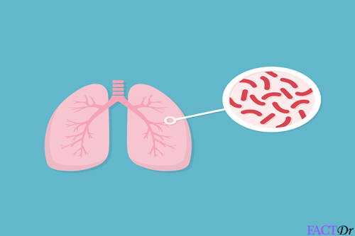 Mycobacterium tuberculosis Symptoms, causes