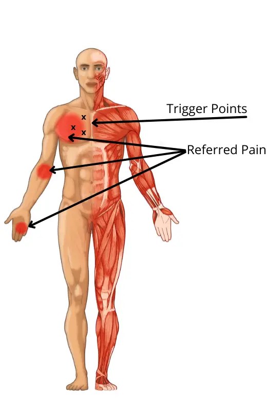 How to Recover from Pectoral Muscle Pain (12 Exercises) Facts & Physio