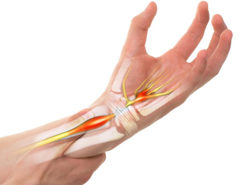 7 Causes of Shoulder Pain and Tingling in the Fingers Facts & Physio