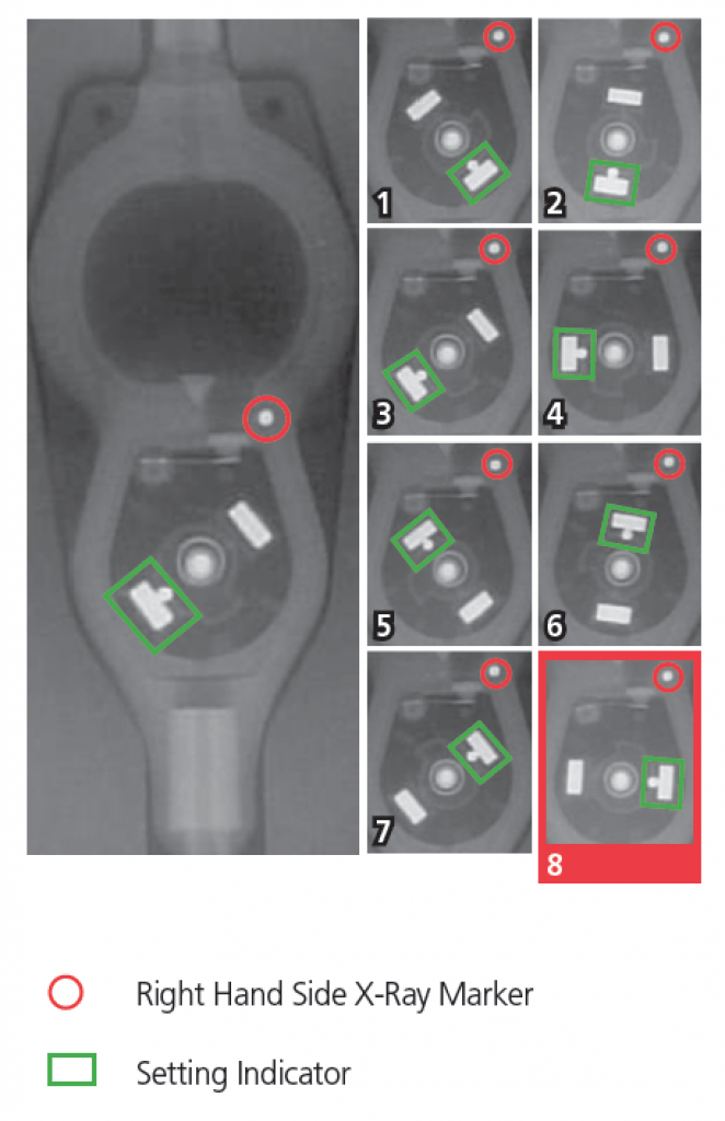 Determining Settings of Programmable VP Shunts UW Emergency Radiology