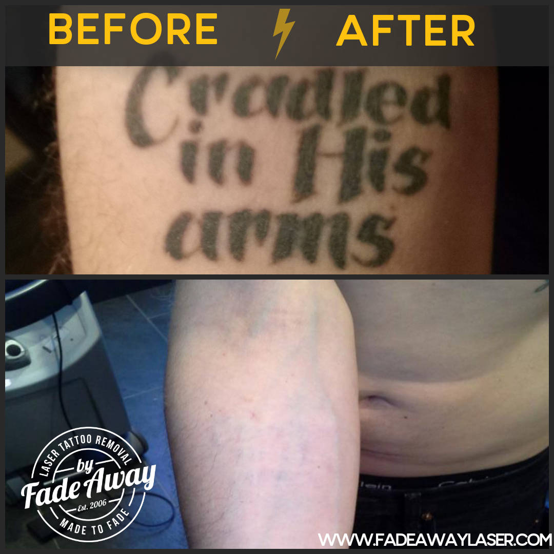 Portfolio Fade Away Laser