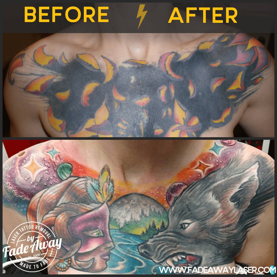 Portfolio Fade Away Laser