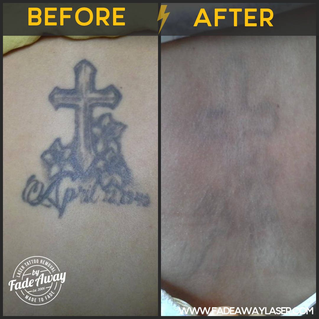 Portfolio Fade Away Laser