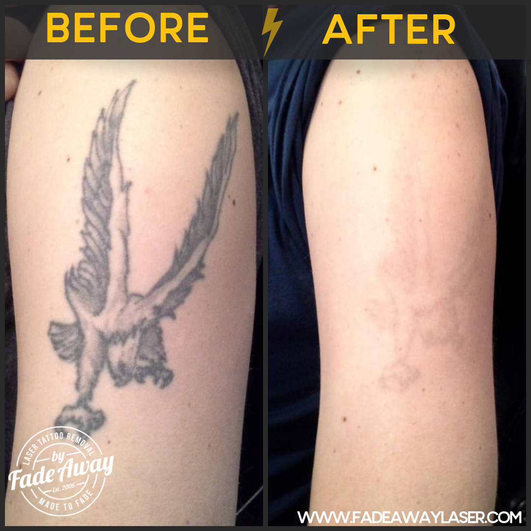 Portfolio Fade Away Laser