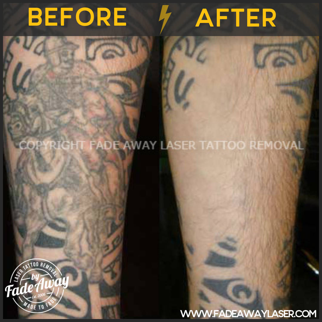 Portfolio Fade Away Laser