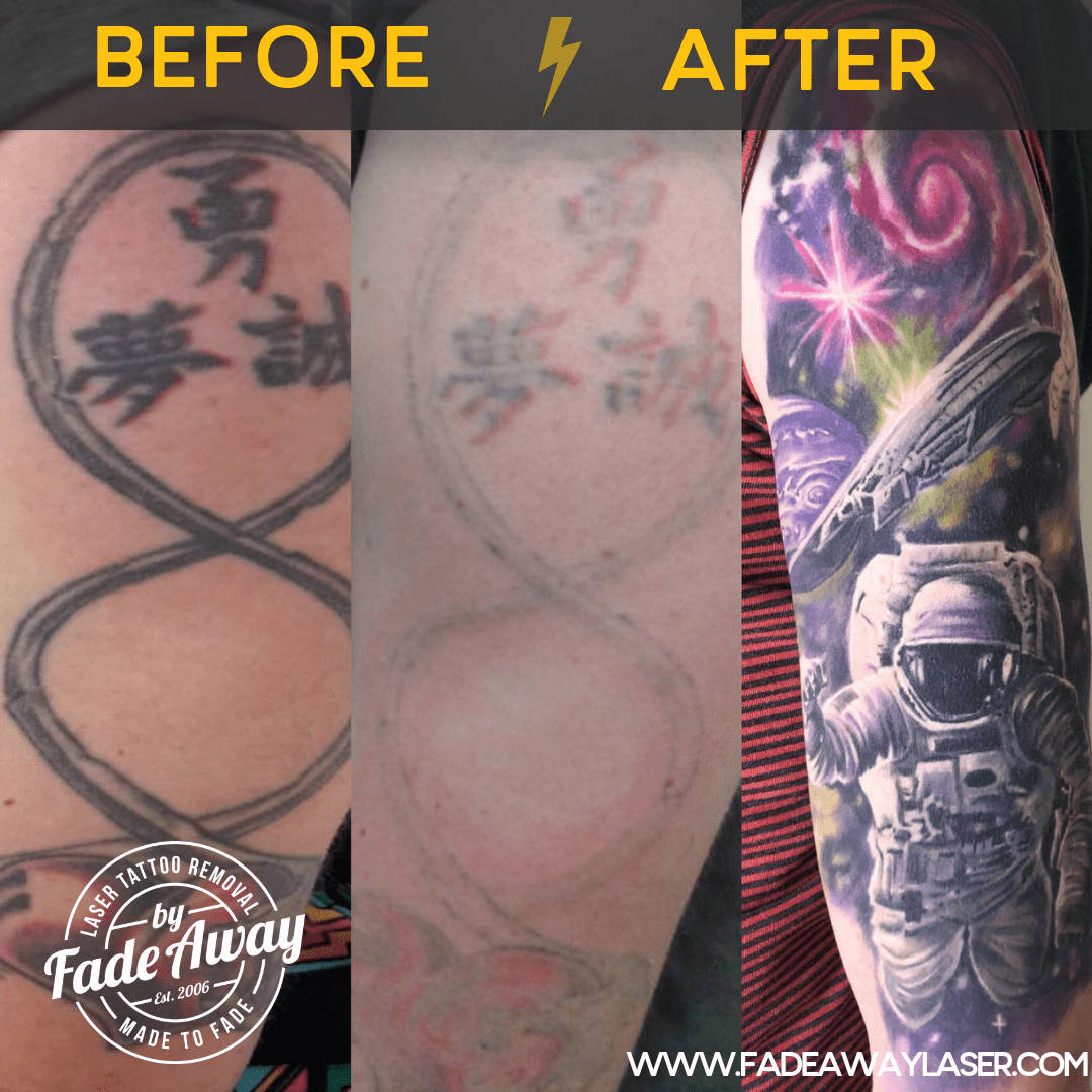 Portfolio Fade Away Laser