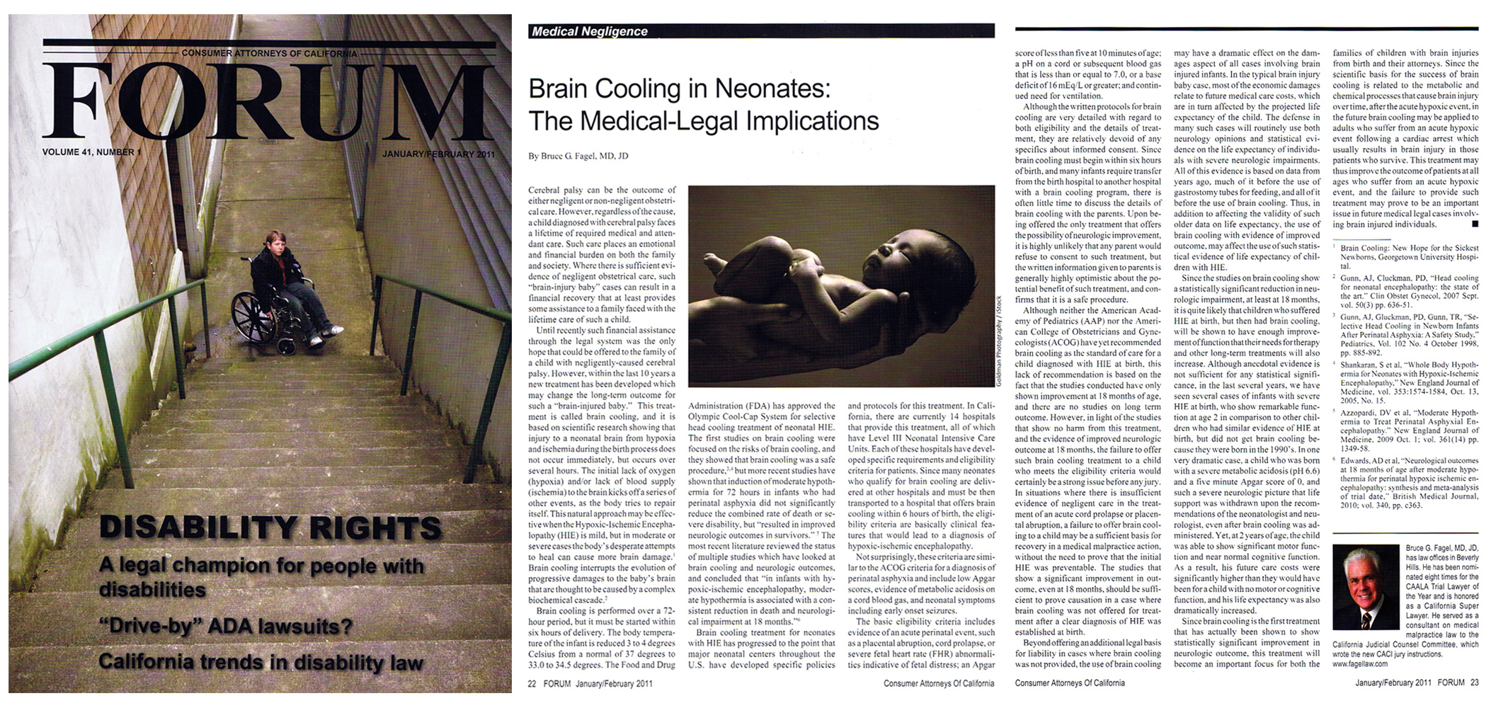 Brain Cooling in Neonates The MedicalLegal Implication California