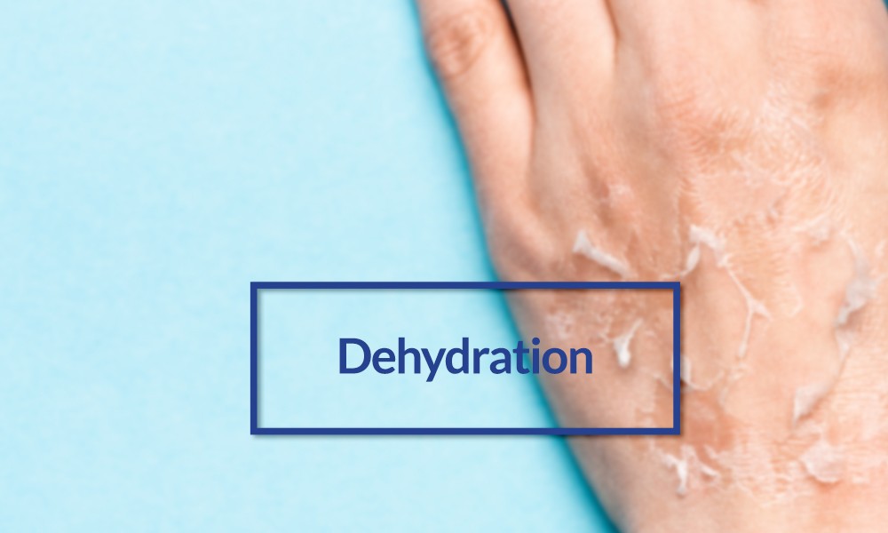 Dehydration Effects on Body Dr Faisal Dar