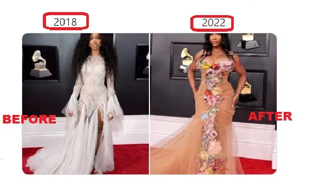 Sza Bbl Did Sza Get A Bbl Sza Bbl Before And After