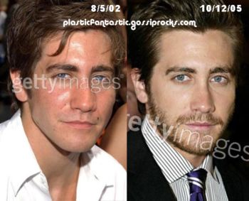 Jake Gyllenhaal Plastic Surgery: Nose Lift Or Rhinoplasty?