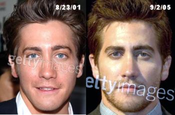 Jake Gyllenhaal Plastic Surgery: Nose Lift Or Rhinoplasty?