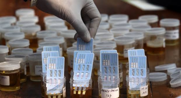 Tes Urine Acak, 5 Polisi di Aceh Positif Narkoba FANEWS.ID Tes Urine Acak, 5 Polisi di Aceh Positif Narkoba FANEWS.ID