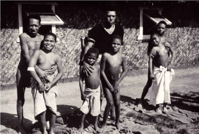 O que é a doença de Kuru?